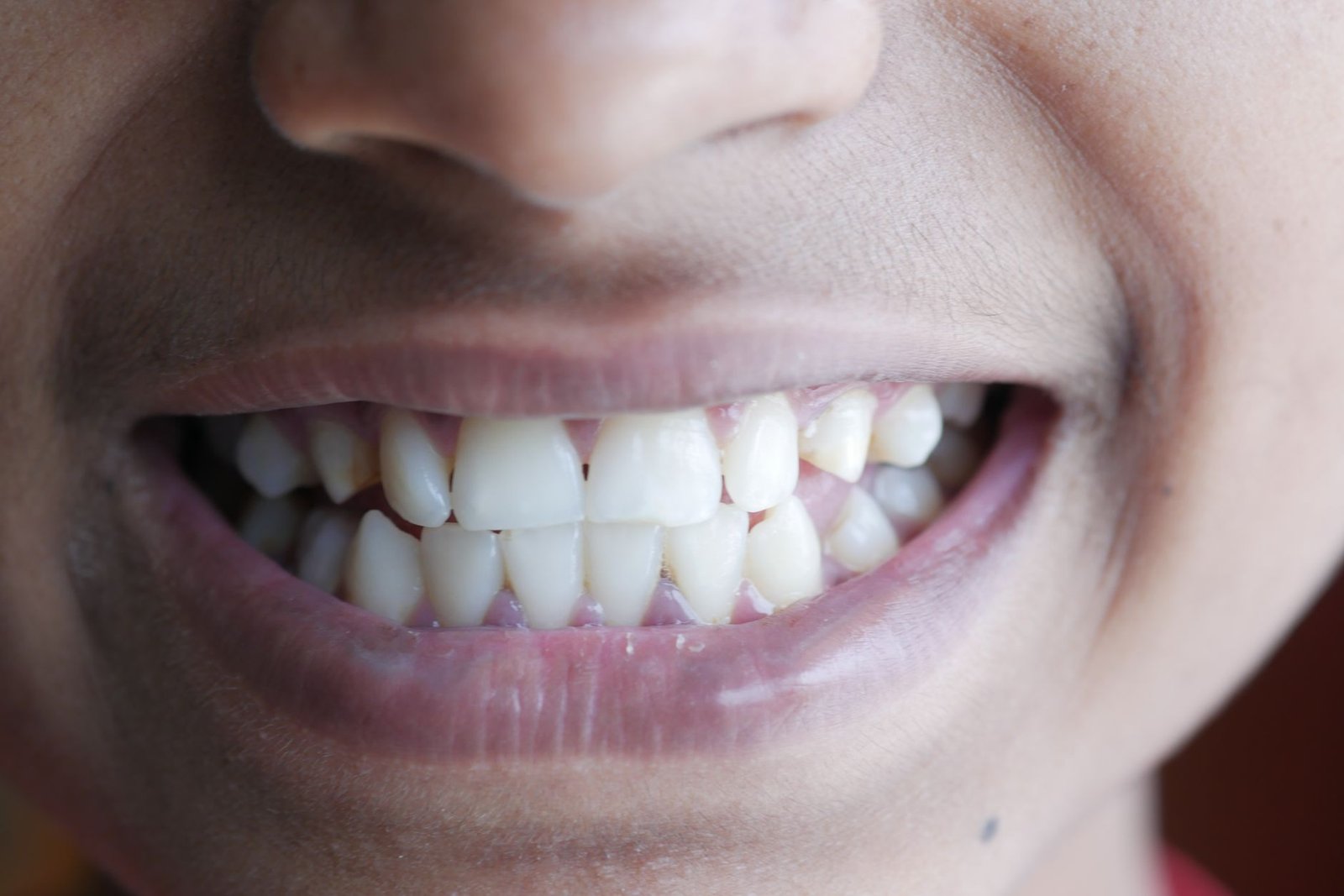 cuándo elegir irrigador o hilo dental